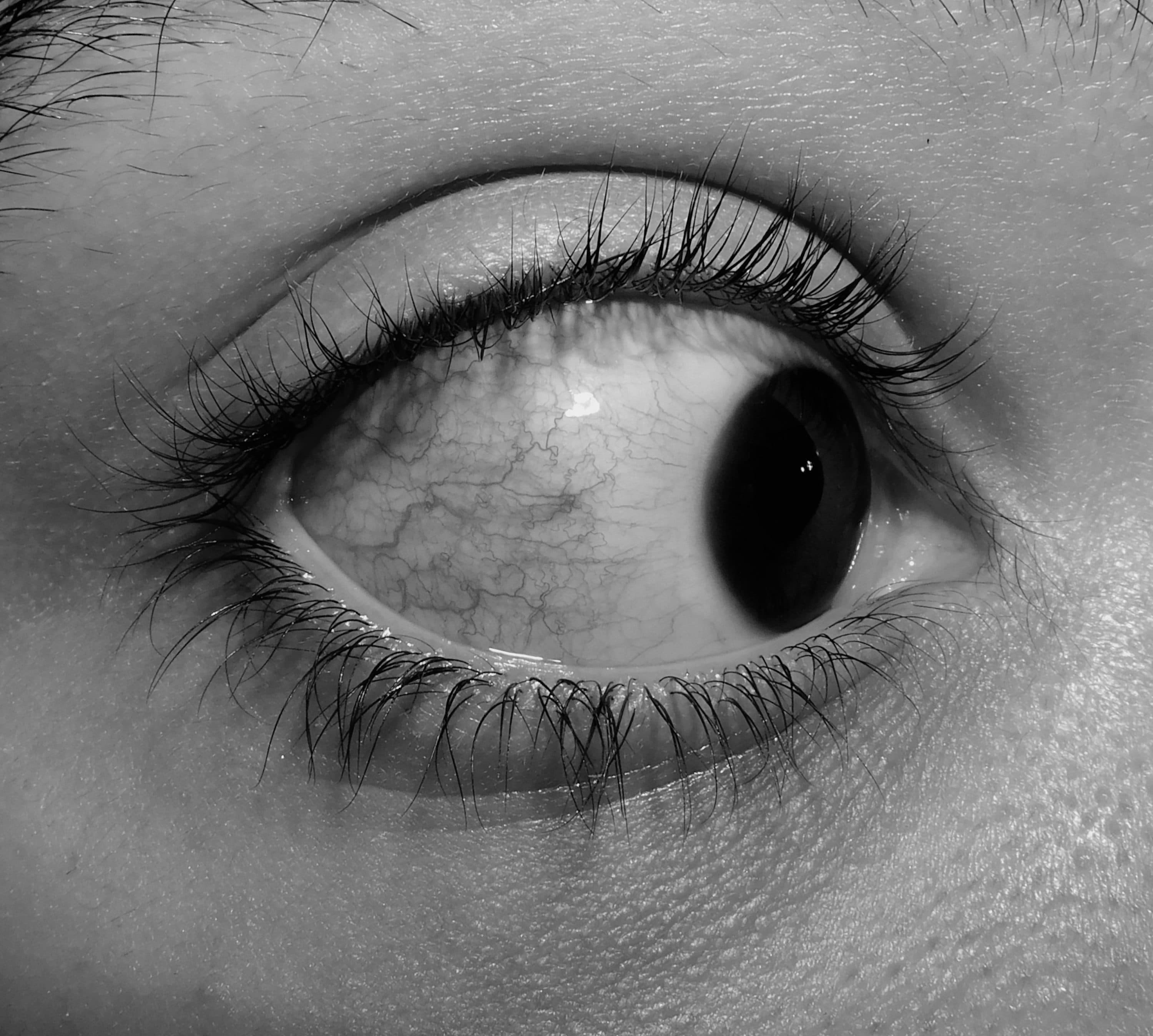 An eye